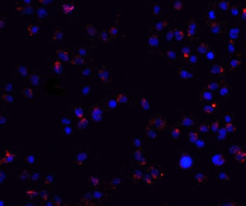 ZEB2 Antibody