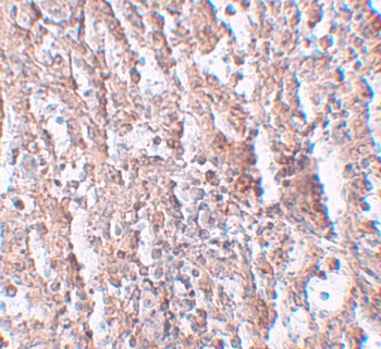 ZIP5 Antibody