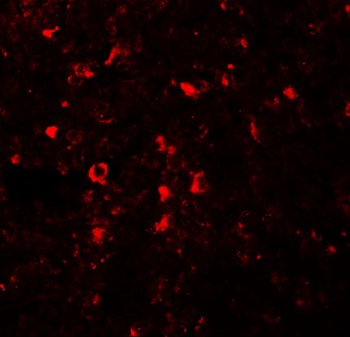 ZIP5 Antibody