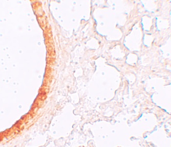 SLC39A3 Antibody