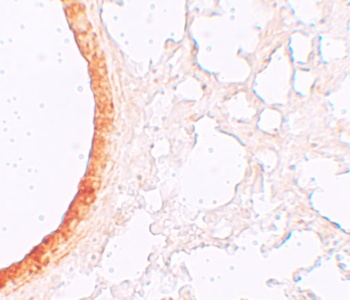 ZIP3 Antibody