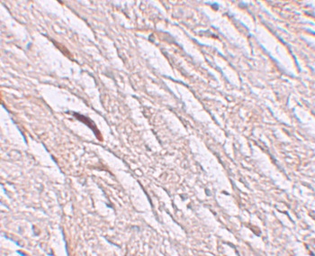 SLC39A2 Antibody