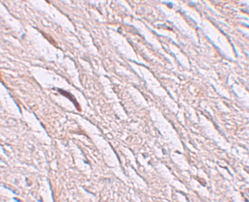 ZIP2 Antibody