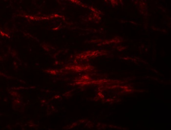ZIP2 Antibody