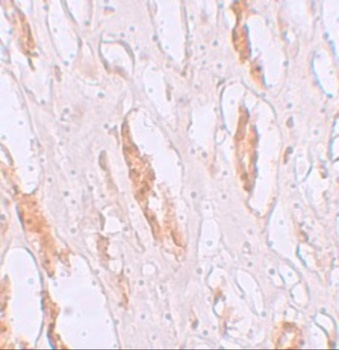 SLC39A1 Antibody