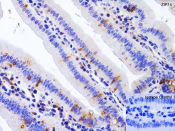 ZIP14 Antibody