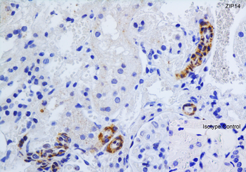 ZIP14 Antibody