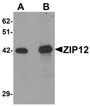 ZIP12 Antibody