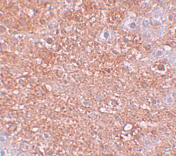 Slc39a12 Antibody