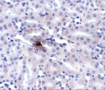 ZIP11 Antibody