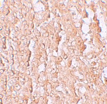 ZIP10 Antibody