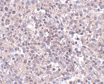 ZIP10 Antibody