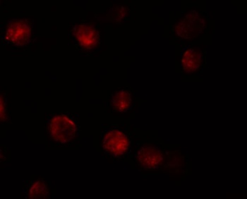 ZMIZ1 Antibody