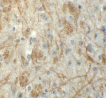 ZFP219 Antibody