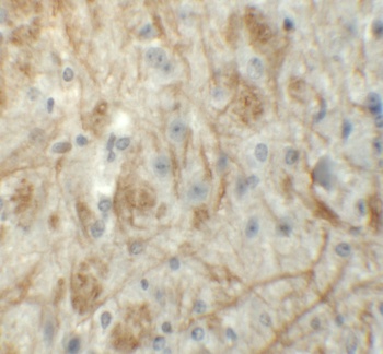 ZNF219 Antibody