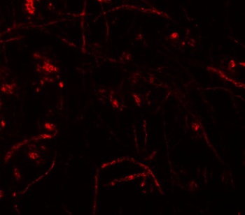 ZNF219 Antibody