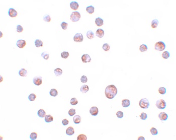 ZC3HAV1 Antibody