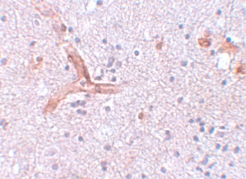 ZC3H12C Antibody