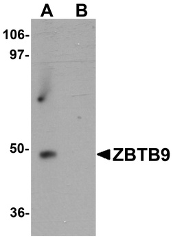 ZBTB9 Antibody