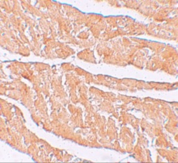 ZBTB9 Antibody
