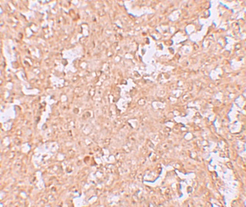 ZBTB8 Antibody
