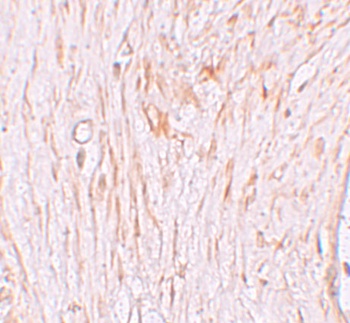 ZBTB7A Antibody