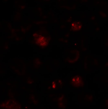 ZBTB6 Antibody