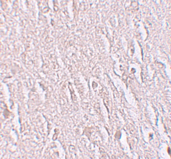 ZBTB5 Antibody