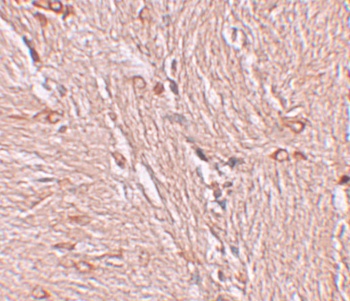 ZBTB4 Antibody