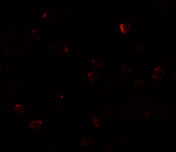 ZBTB40 Antibody