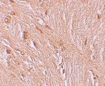 ZBTB3 Antibody
