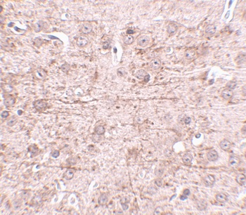 ZBTB1 Antibody