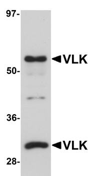 Pkdcc Antibody