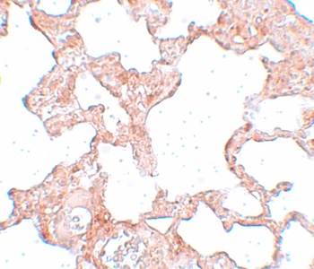 Pkdcc Antibody