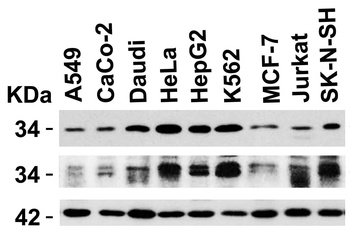 UNG1 Antibody
