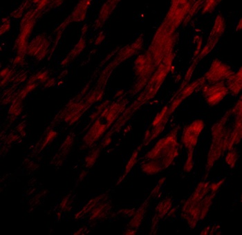 UNG1 Antibody