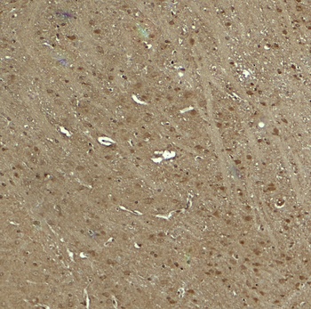 WWC1 Antibody