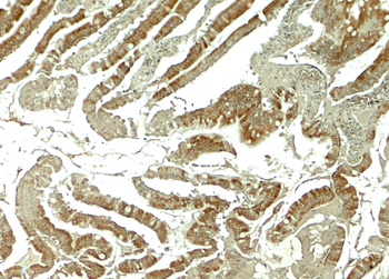 WNT5B Antibody