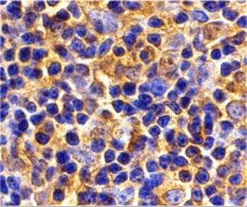 UBC13 Antibody