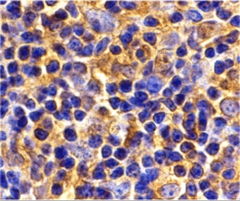 UBE2N Antibody