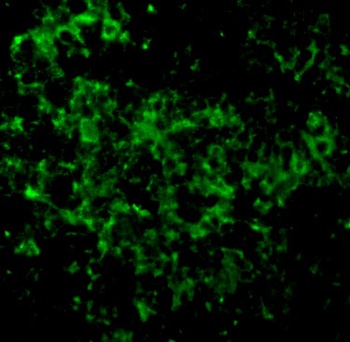 UBE2N Antibody