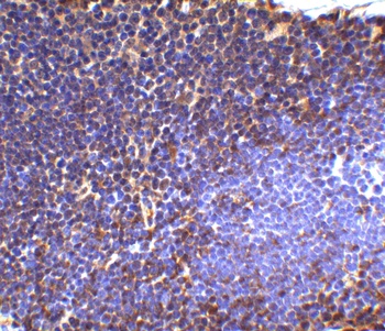 UBC13 Antibody