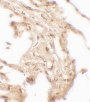 WFDC2 Antibody