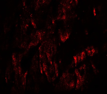 WAPL Antibody