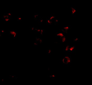 VPS53 Antibody