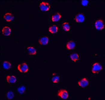 TRPC6 Antibody