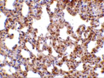 TRPC6 Antibody