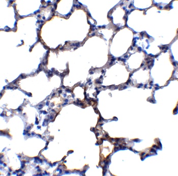 TRPC6 Antibody