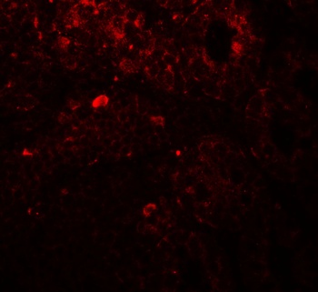 TRIP12 Antibody