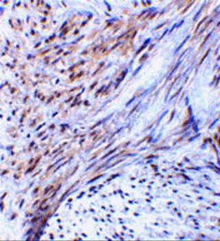 TRIM5 Antibody